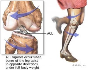 acl2